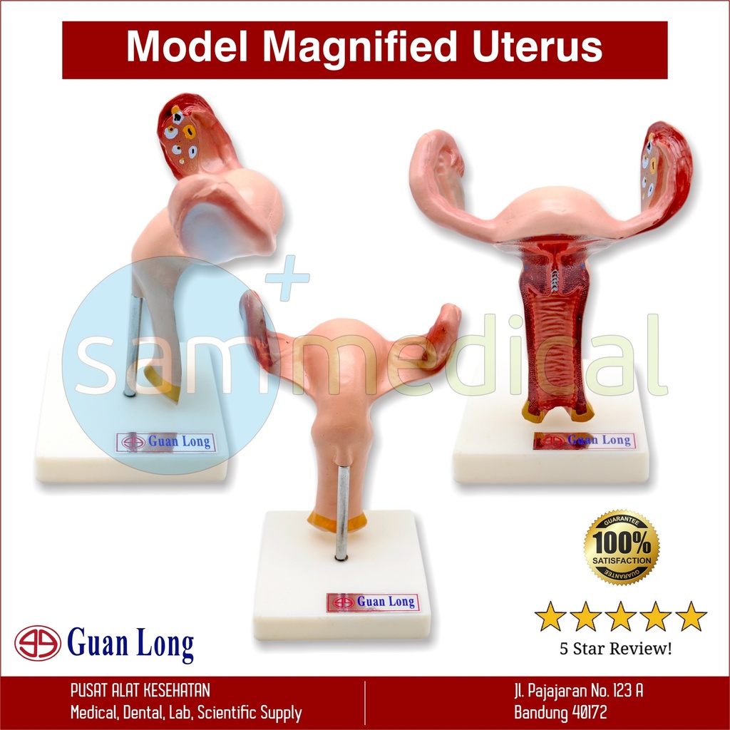[001820160002] Guan Long Model Magnified Uterus GL-8436A