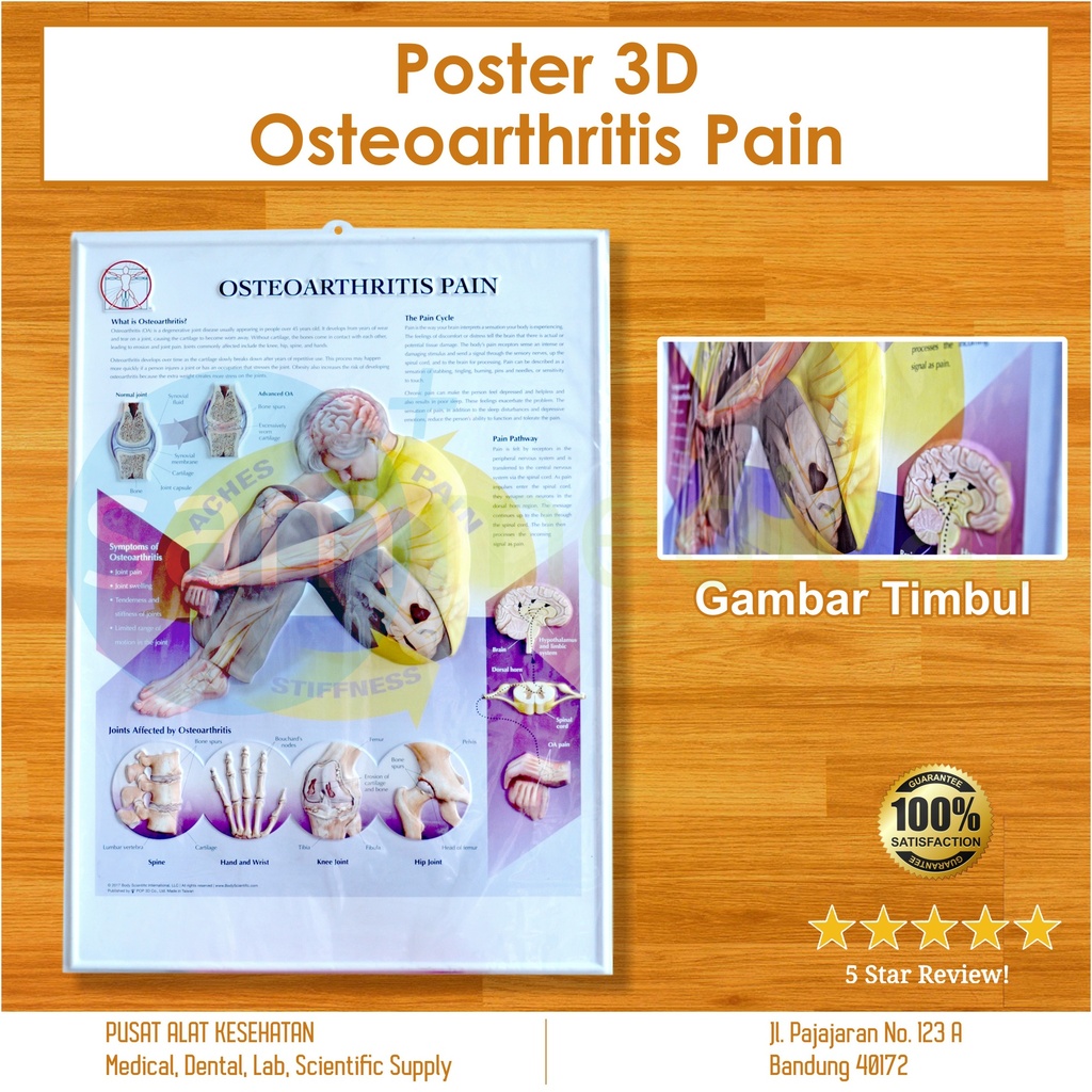 [00120180448] Poster 3D Osteoarthritis Pain BS 137RR