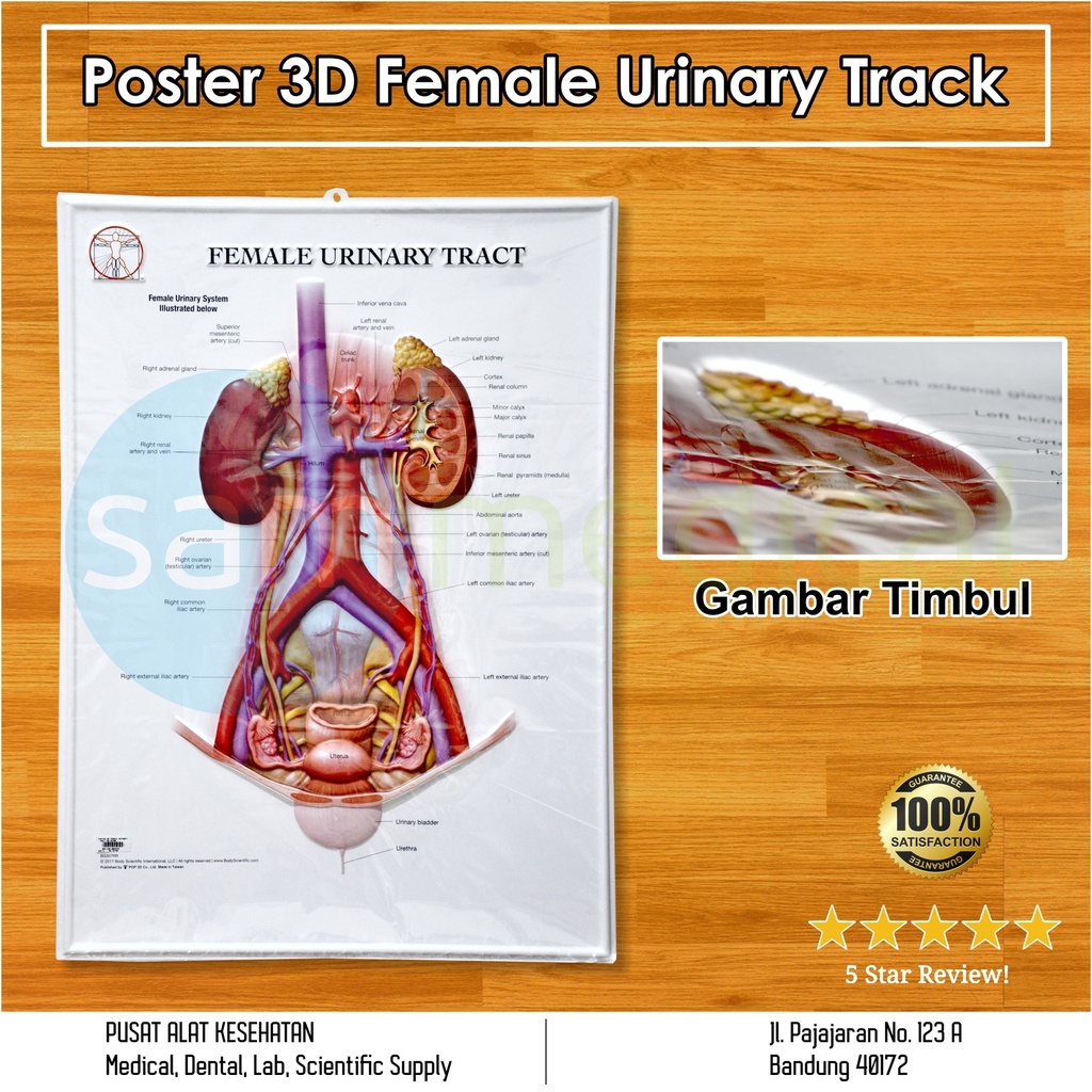 [00120180454] Poster 3D Female Urinary Tract BS 307RR