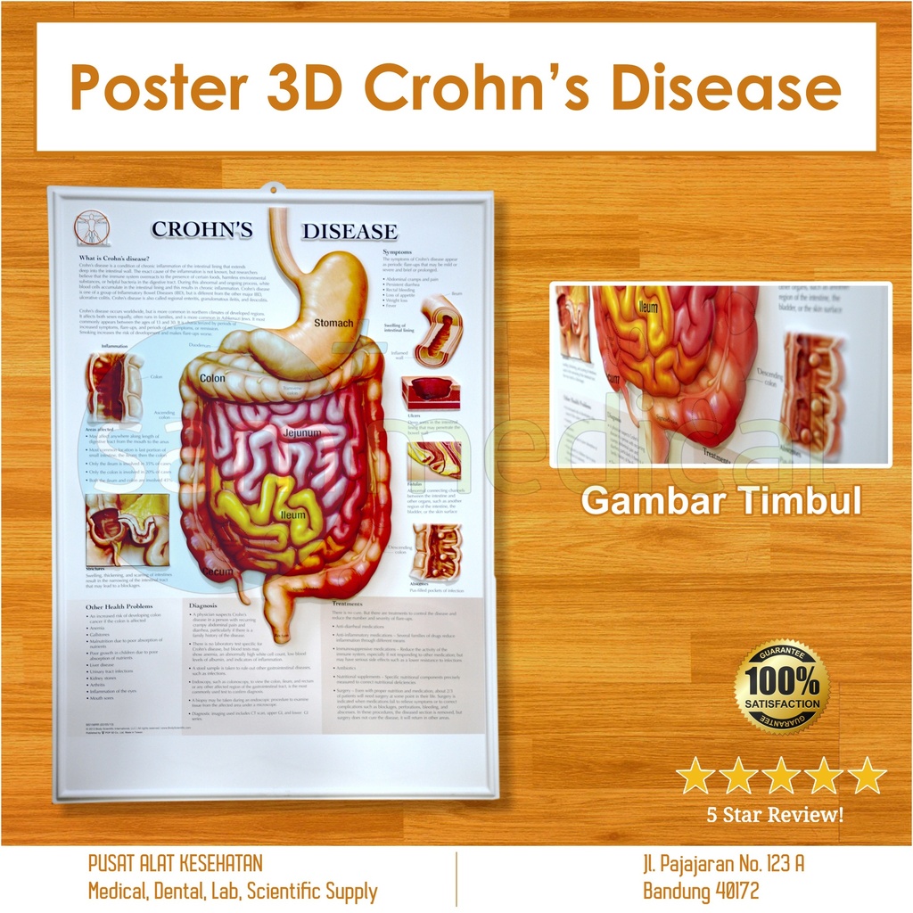 [00120200250] Poster 3D Chron's Disease BS 156RR