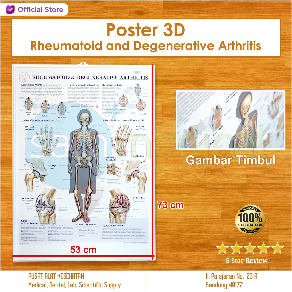 [00120200251] Poster 3D Rheumatoid and Degenerative Arthritis BS112RR