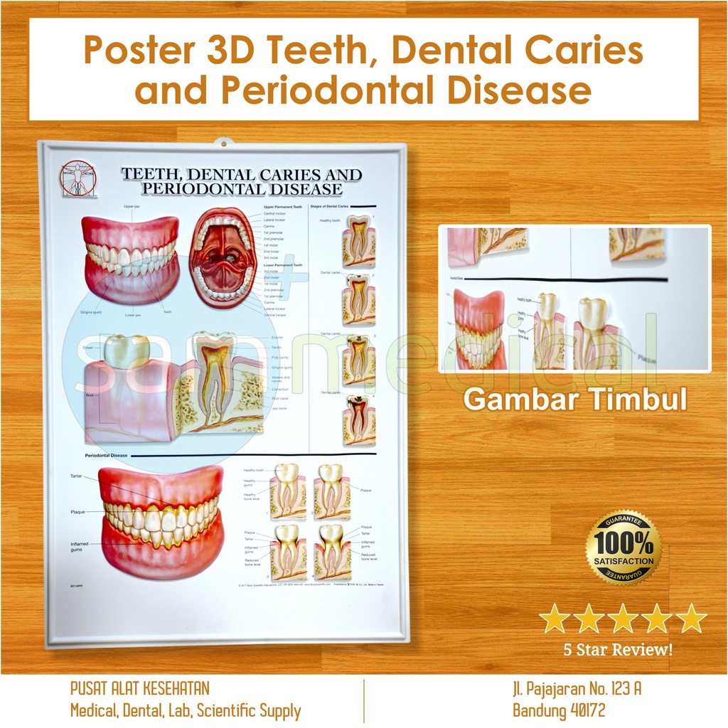 Poster 3D Teeth Dental Carries and Periodontal Disease BS 148RR