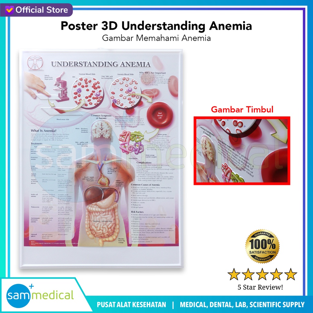 [00120230288] Poster 3D Understanding Anemia BS 181