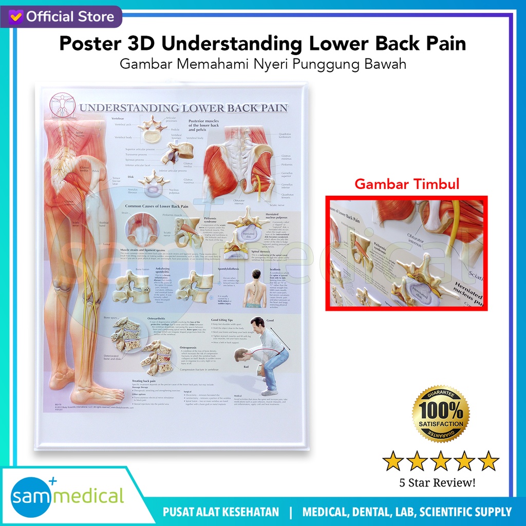 [00120230295] Poster 3D Understanding Lower Back Pain BS 170