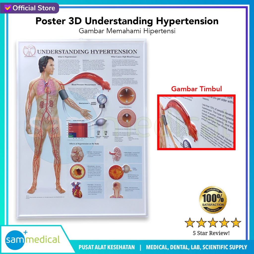 Poster 3D Anatomical Understanding Hypertension BS 121