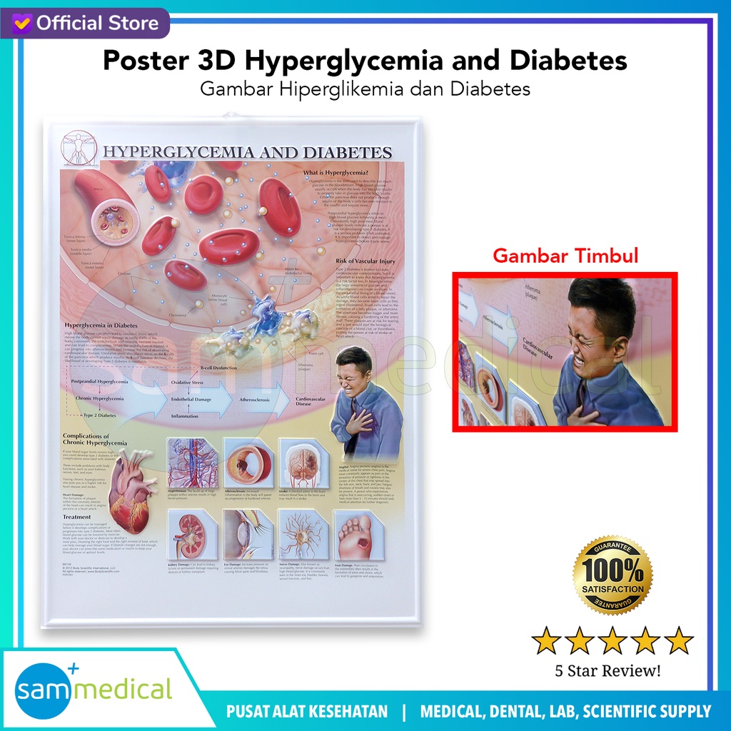 [00120230299] Poster 3D Hypergilycemia and Diabetes BS 140
