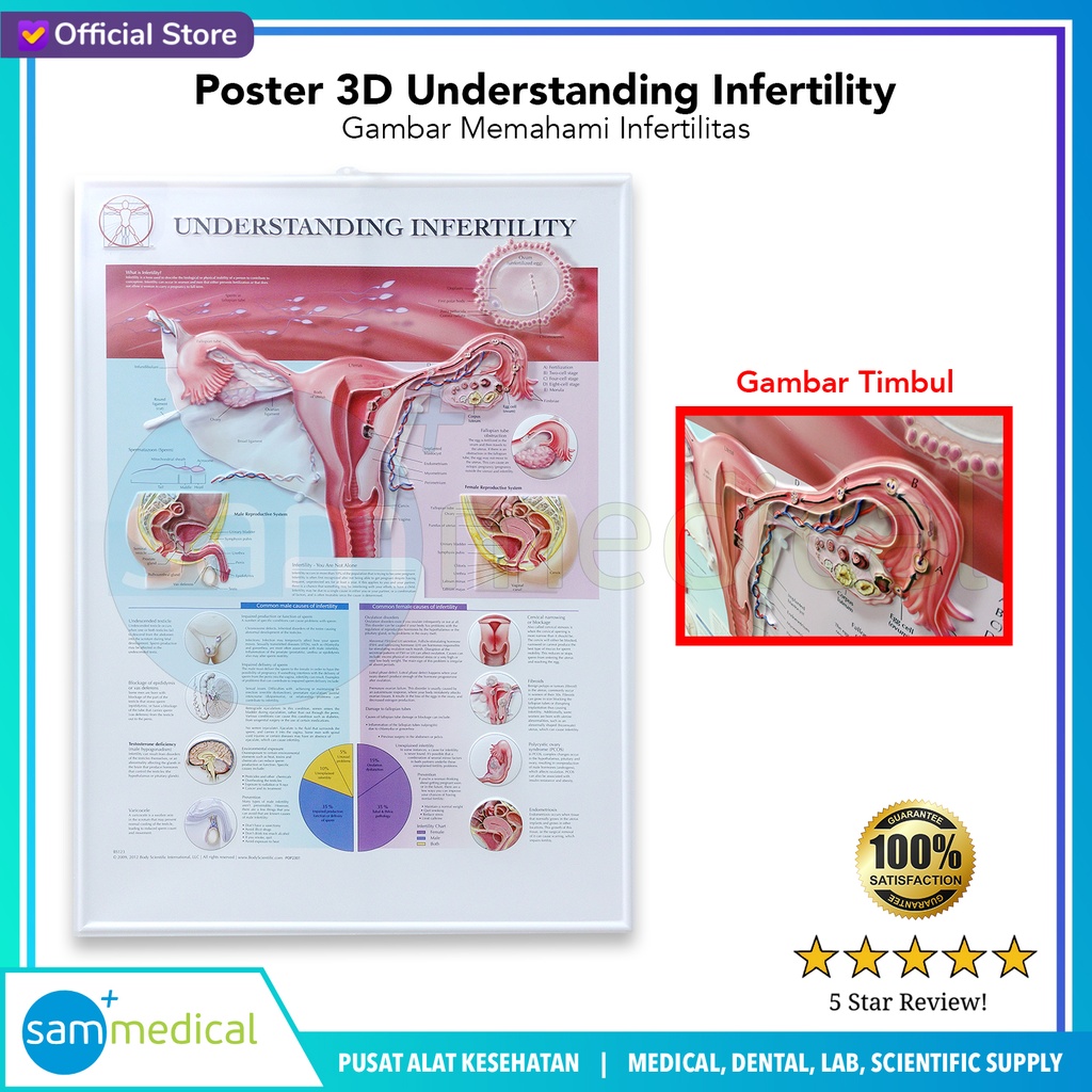 Poster 3D Anatomical Understanding Infertility BS 123RR | sam medical